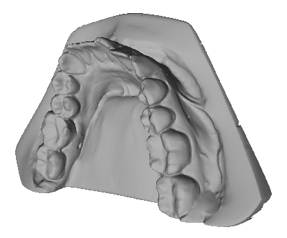 You are currently viewing DIGITAL MODELS, VIRTUAL SET UP AND ALIGNERS
